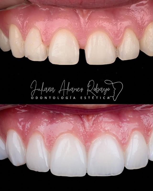 Ortodoncista en Cali