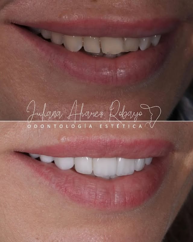 Periodoncista en Cali