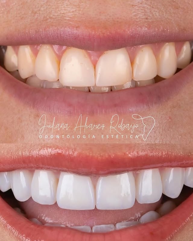 Prostodoncista en Cali